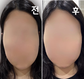 제 얼굴에 맞는 부위 디자인도 꼼꼼히 체크 해 주십니다!