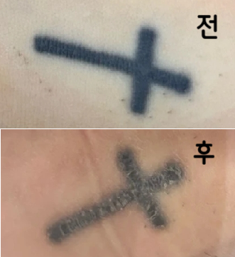 원장님 너무 친절하시고 상담 실장님도 딱 원하는 상담만 하고 다른거 권유 안해서 좋았어요~