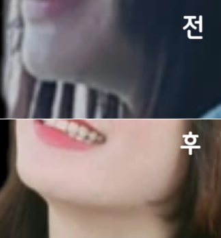 효과 있길래 몇 번 더 맞아보려구요~