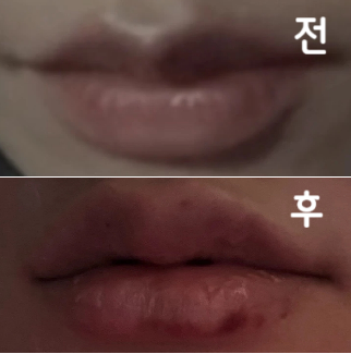 병원 쾌적하고 다들 친절하세요 원장님도 꼼꼼히 봐주셔서 좋았습니다!