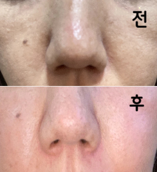 선생님과 직원이 매우 친절합니다! 피부가 좋아졌어요! 또 꼭 가고싶어요~