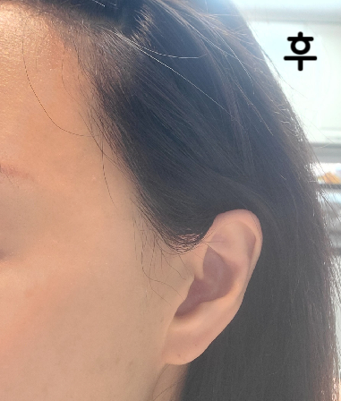 오늘 시술해주신 원장님~ 너무 감사해요 ♥ 진짜 잘 놔주시고~ 마사지 오래 해주시고~ 체크 + 체크 +체크 트리플 체크 ㅠㅠ