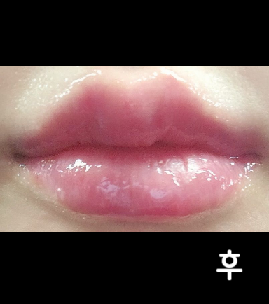 작년 5월에 여기서 받고 만족스러워서 다시 재방문했습니다!