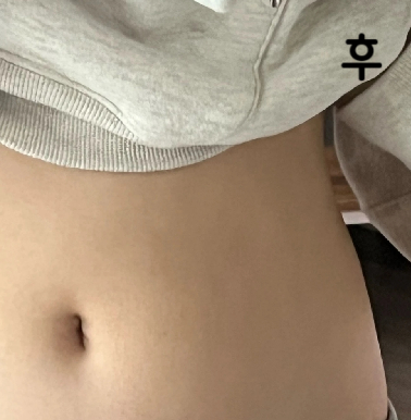 대기시간은 생각보다 없었고, 의사선생님이 친절하셔서 처음 받는 시술도 편하게 잘 받았어요!!
