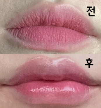 얼태기였는데 모양도 과하지 않게 맘에 들어서 친구들한테도 추천하고 저도 다른 시술도 해볼까합니다!!