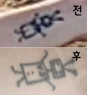 생각보다 안 아팠고 마취크림 발라주시는 선생님께서 너무 친절하셔서 좋았어요~