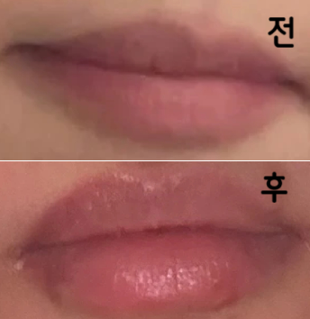 제가 딱 원하는 정도로만 자연스럽게 볼륨감만 추가된 느낌이라 너무너무 만족합니다!