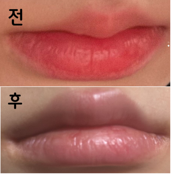 더 하고 싶은 곳은 없는지 물어봐주시고 몇 cc 넣었는지 잘 알려주셔서 좋았어용