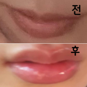 입술에 볼륨감이 생기니까 얼굴도 더 살아 보이고 화장 할 맛도 나고 좋아용 ㅎㅎ