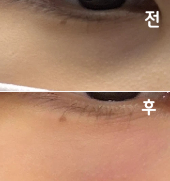 김용건 원장님 세심하고 친절하게 잘 해주셨어요~