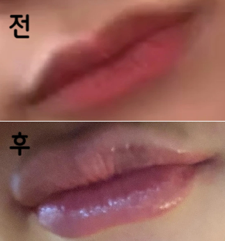 시술은 완전 맘에 듭니다! 사진은 리터치 후 사진입니당!