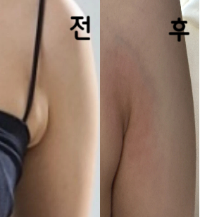 사람이 엄청 많아서 대기시간은 걸렸지만 원장님께서 친절히 해주셔서 감사했습니다!