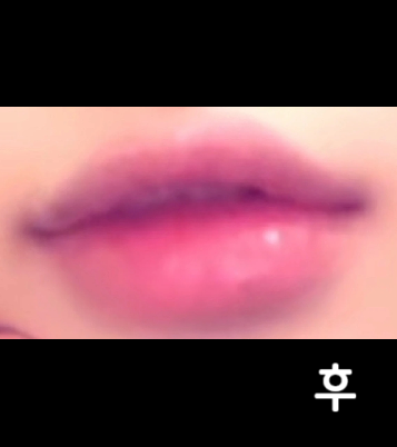 입술필러는 항상 여기서 받아요!! 대기시간도 길지 않고 친절하시구 정말 너무너무 만족합니당~