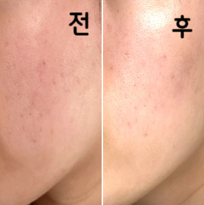 모공 등의 개선은 잘 모르겠지만 피부 윤기와 탄력이 생긴 느낌이 듭니당!