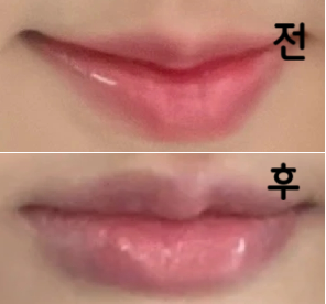 필러 넣는 중간중간 계속 물어보시고 모양 체크를 해주셔서 좋았어요~