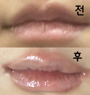 안 아프게 놔주셔서 좋았어여~ 대기시간 긴데 그래도 친절하셔서 괜찮았습니다 :)