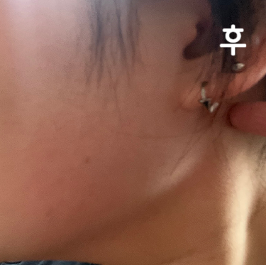 얼굴라인 정리로는 최고인 것 같아요~