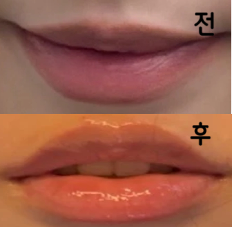 처음에 아플 줄 알고 너무 긴장했는데 그래도 결과물 잘 나왔어용! 가격대비 진짜 잘 돼서 너무 기쁩니다!!