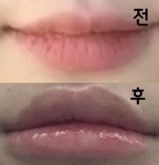 원래 입술이 두꺼운 편이라 괜찮을까? 생각했는데 안 했으면 후회할번 ㅜ 진짜 왕추천!