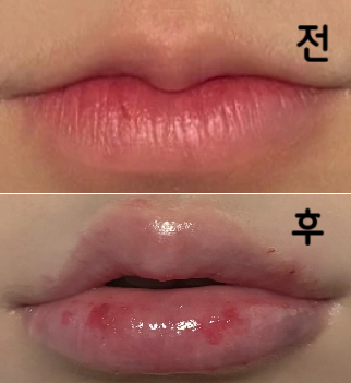 안 아프게 잘 해주시고 중간 중간 확인 시켜주시면서 원하는대로 해주셔서 좋았어요~