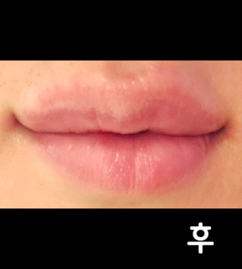 원장님이 친절하게 잘 해주십니다 ㅎㅎ