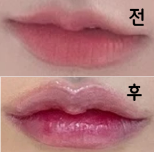 두 번째 시술인데 너무 친절하시고 필러도 너무 만족해요 ㅠㅠ