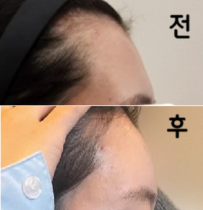 생각보다 양이 많아서 너무 둥글지 않을까 걱정했는데 자연스럽게 동글어졌어요! 롤리팝 추천합니다!