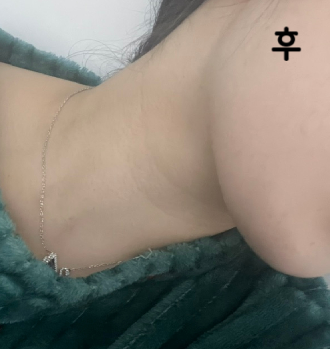 의사 쌤 넘 좋고 전 스테로이드 있는 거 맞았는데 붓기 빨리 빠져요!! 친절하세요 다들~