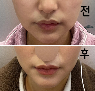 얼굴에 살이 올라온 거 같은 느낌이 들면 바로 방문하는 곳이에요!