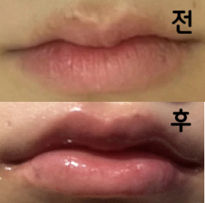 상담 실장님이 너무 친절하셔서 좋아요!! 시술도 잘 해주셨어요~