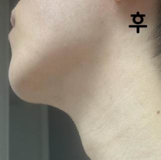 엄청 친절하시고 꼼꼼하게 보고 놔주십니다! 별로 안 아프고 효과 대만족입니다!