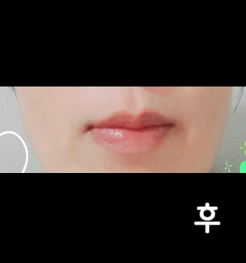 병원 시설이 깨끗하고 모두 친절하십니다!