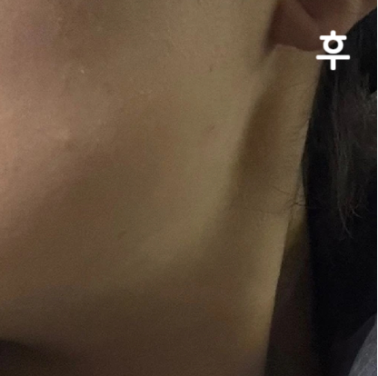 오래 기다리긴 했지만 의사 선생님이 친절하셨어요~