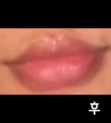 입술필러 맘에 안들어서 녹인 적도 몇 번 있는데 처음부터 이렇게 맘에 드는 모양 첨봐요!! 넘 맘에 들어용~