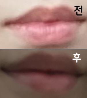 입술 사이드 부분이 얇아서 고민이었는데 엄청 섬세하게 넣어주셨어요~