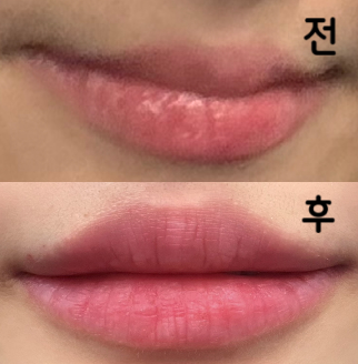 엄청 꼼꼼한 상담부터 필요한 부분만 딱딱 집어내 끝내주셔 정말 만족했어요! 리터치도 받고 계속 꾸준히 받으러 갈 계획입니다~~:)