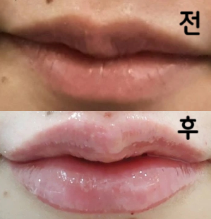 대기도 거의 없고 클리닉도 청결하고 업셀도 없이 자신에게 맞는 플랜을 제안해주셔서 좋았어요. 닥터와 직원도 매우 친절했습니다!