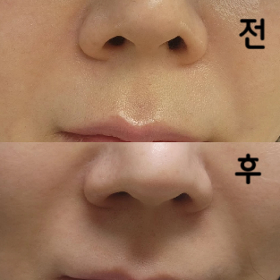 최원장님 너무 친절하시고 섬세히 잘 해주셨어요!