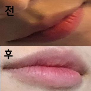 너무 만족해요,, 왜 이제 맞았지 싶어요 ㅜㅜ 강추합니다!