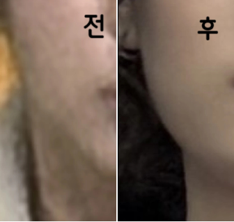 너무 친절하시구 긴장했는데 잘 다독여 주셨어요 담에 또 갈 듯 해요~