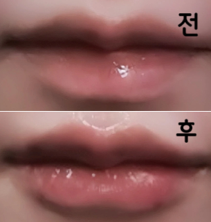 추가사항을 정중하게 들어줘서 이상적인 입술이 되었기 때문에 마무리에 관해서는 굉장히 만족합니다!