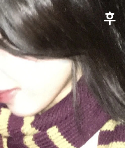 일본어 통역하시는 분도 계셔서 굉장히 저에게 맞는 시술을 해주셨습니다! 효과도 대만족입니다!