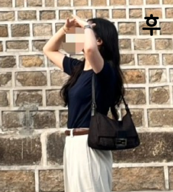 거의 5번 이상 시술 중이에요! 몸이 부운 것 같으면 시술을 받는데 효과 직빵입니다 ㅎㅎ