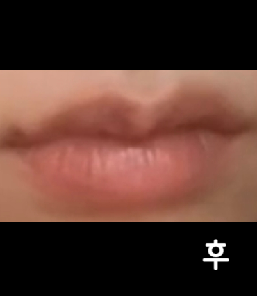 진짜 너무 맘에 들어서 필러 빠지면 계속 여기로 올 듯 해여.. ♥