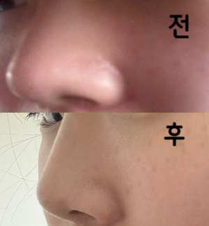진짜 높아졌고 만족스러워여!