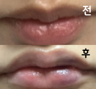 직원분들은 굉장히 친절했지만 멍이 많이 들었어요 ㅠ