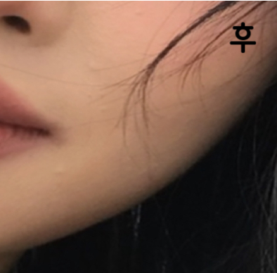 좀 오래걸렸지만 효과는 좋아서 만족합니다! 가격대비 저렴하고 친절도 하시구요 ㅎㅎ