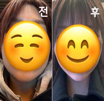 얼굴 지분주는 처음 받았는데 진짜 효과 짱이에요~