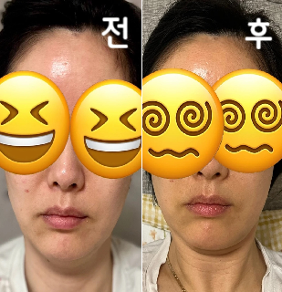 2+1 행사로 3회차까지 마쳤어요! 1회차가 젤 효과가 컸었던 것 같고 유지 차원에서 재방문의사 있습니다!