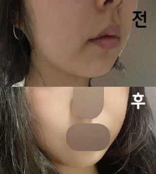 저번에 방문해서 효과가 있는 것 같길래 재방문했어요~